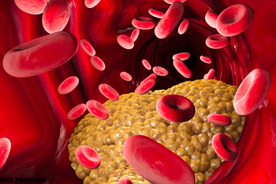 Cardiologista explica como reduzir a gordura no sangue de forma eficaz